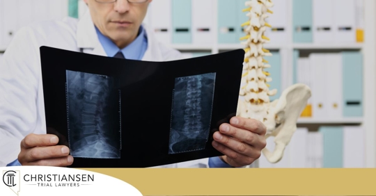 doctors looking at x rays