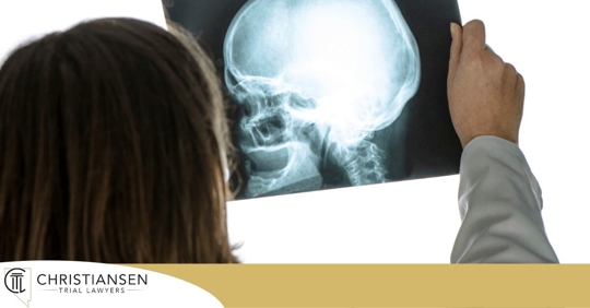 doctor looking at brain scan